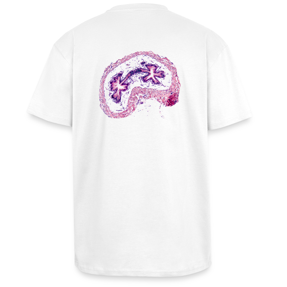 EPIDIDYMIS I back - Heavy Oversized T-Shirt - Weiß